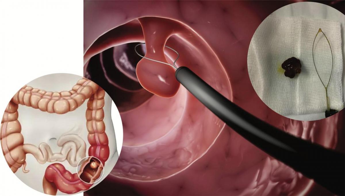 Dr. Gustavo Braga – Coloproctologista Dr. Gustavo Braga – Coloproctologista