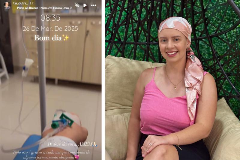 Tainara compartilhou nas redes sociais o início do tratamento